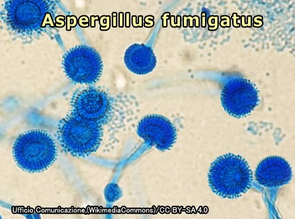 アスペルギルス菌の顕微鏡写真