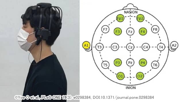 脳波の測定位置